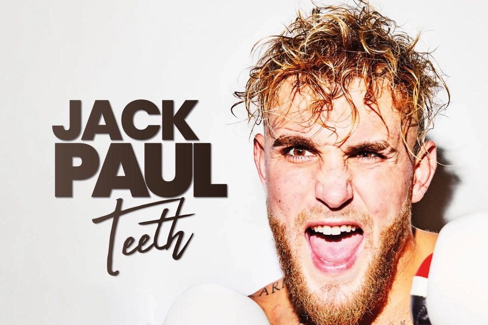 Jake Paul Teeth