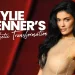 Kylie Jenner’s Aesthetic Transformation