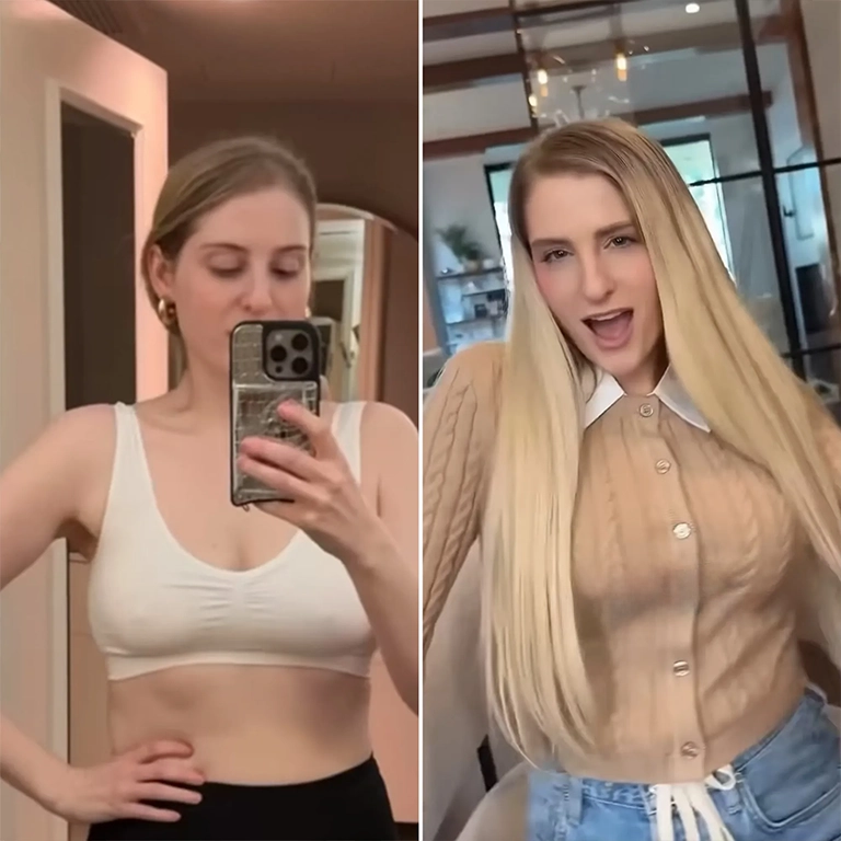Meghan Trainor Before and After Transformation