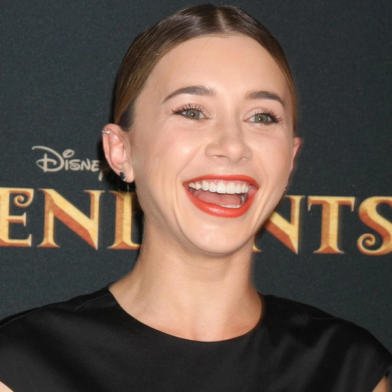 Olesya Rulin Smile Transformation
