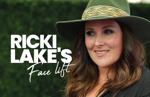 Ricki Lake Face Lift