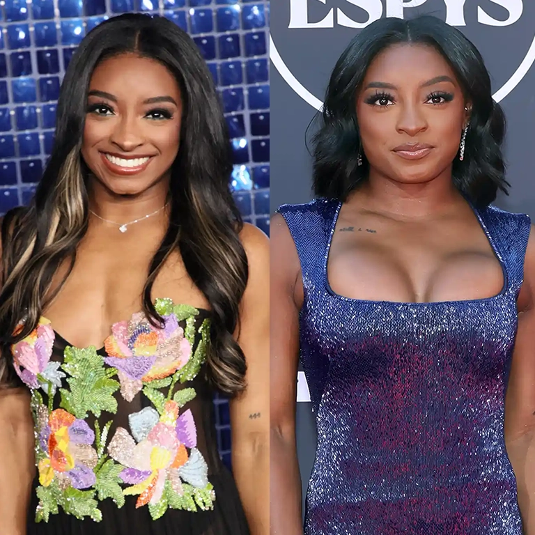Simone Biles Surgery Rumors