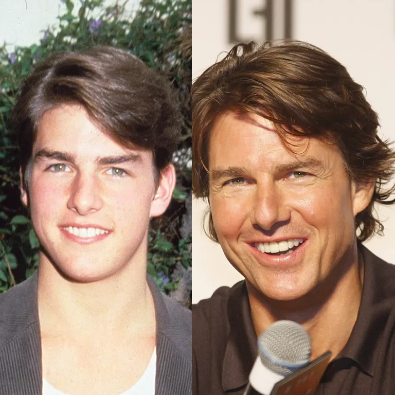 Tom Brady Face Changes