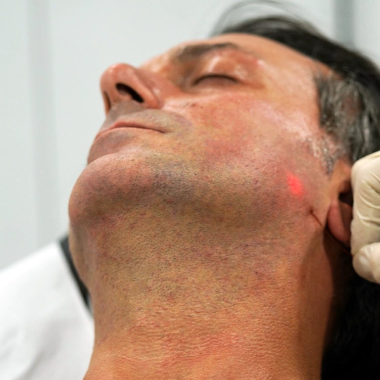 What to Expect The First 48 Hours After Endolift
