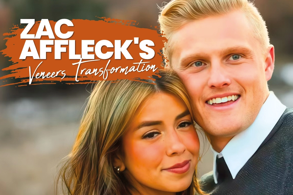 Zac Affleck Veneers Transformation