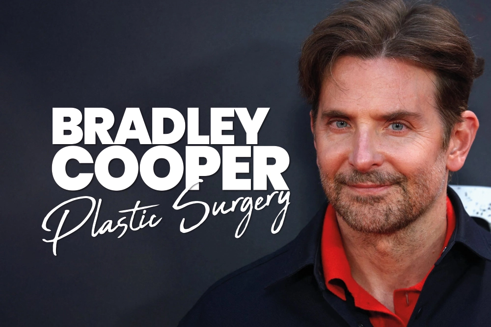 Bradley Cooper Plastic Surgery Before and After: The 2026 Aesthetic Analysis