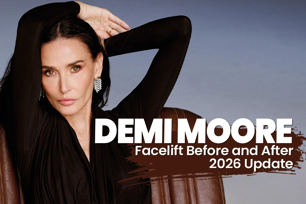 Demi Moore Facelift Before and After 2026 Update