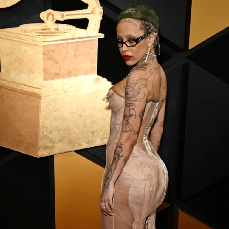 Did Doja Cat Get a BBL The Fat Transfer Denial