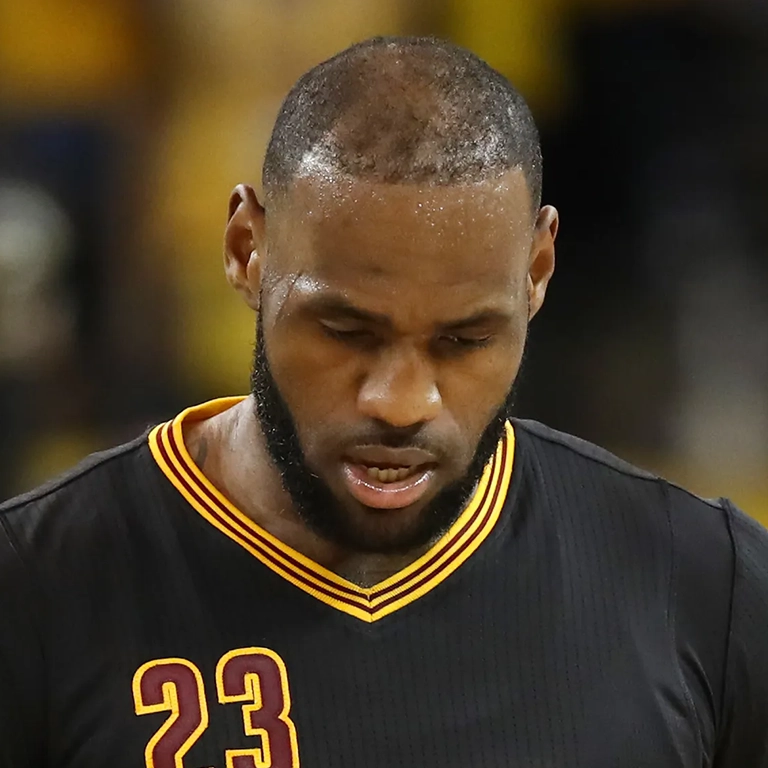 Did LeBron James Get FUE Hair Surgery Expert Analysis