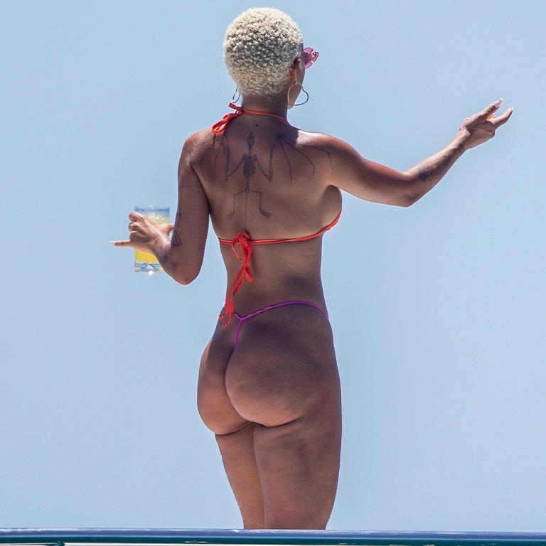 Doja Cat Plastic Surgery 2026 Confirmed Procedures