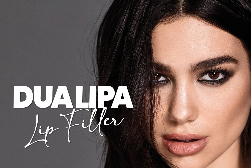 Dua Lipa Lip Filler Before and After 2026