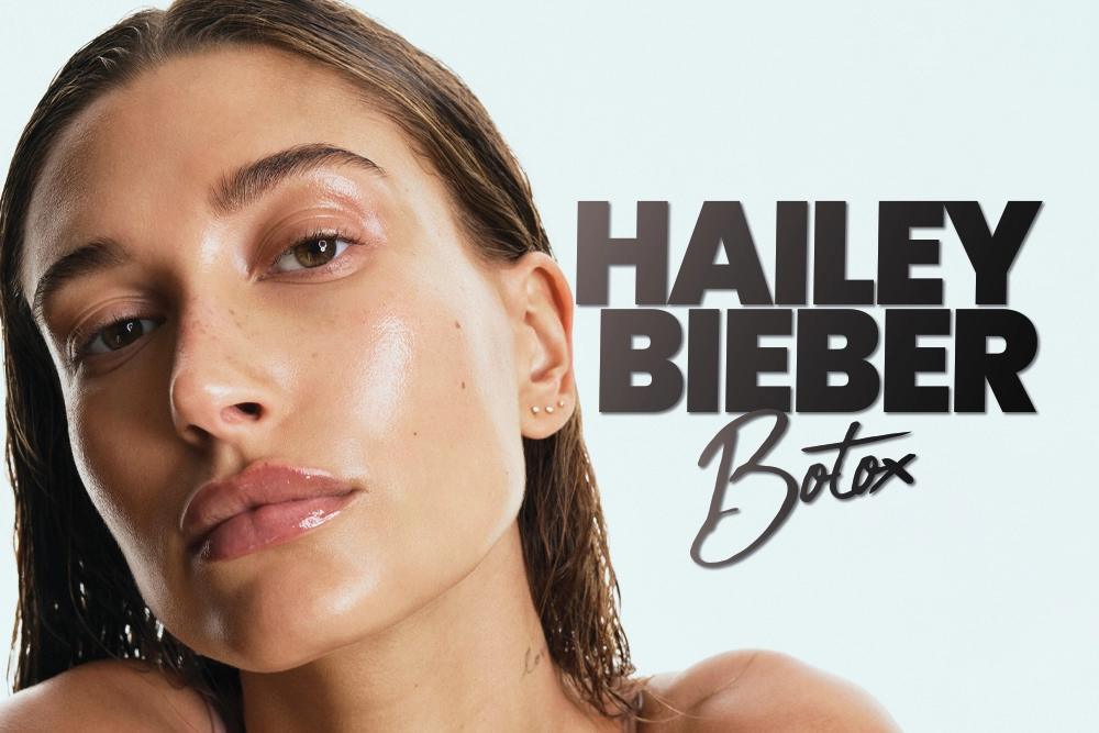 Hailey Bieber Botox Before and After 2026