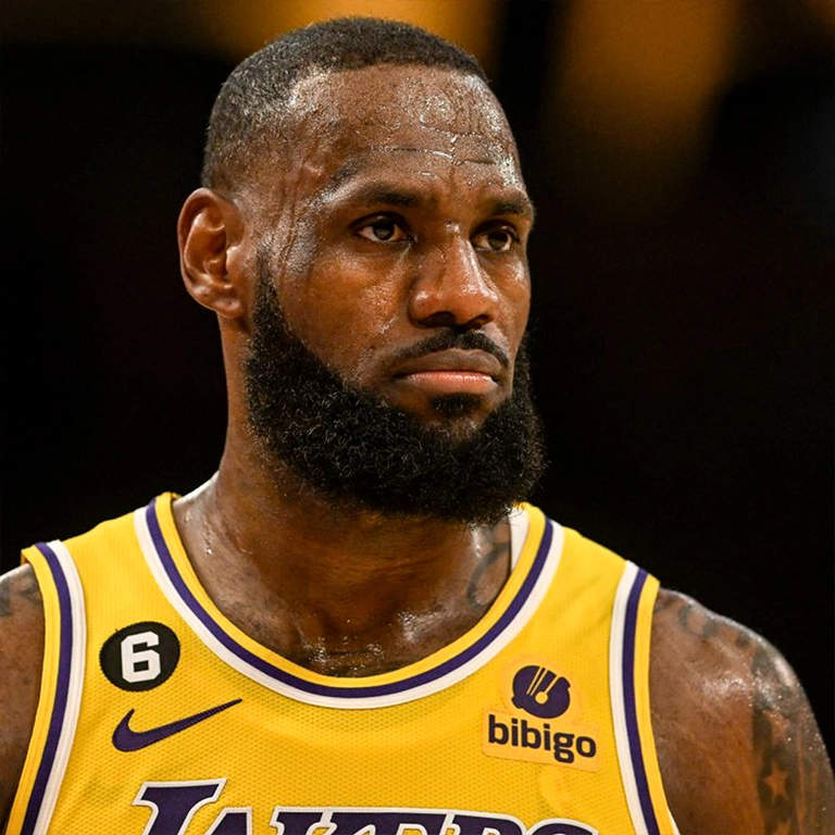 LeBron James Hair Transplant The 2026 Update