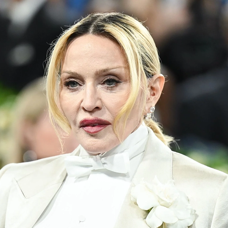 Madonna’s 2026 Face Facelift, Brow Lift, and Blepharoplasty Details