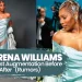 Serena Williams Breast Augmentation Before and After The 2026 GLP-1 Analysis