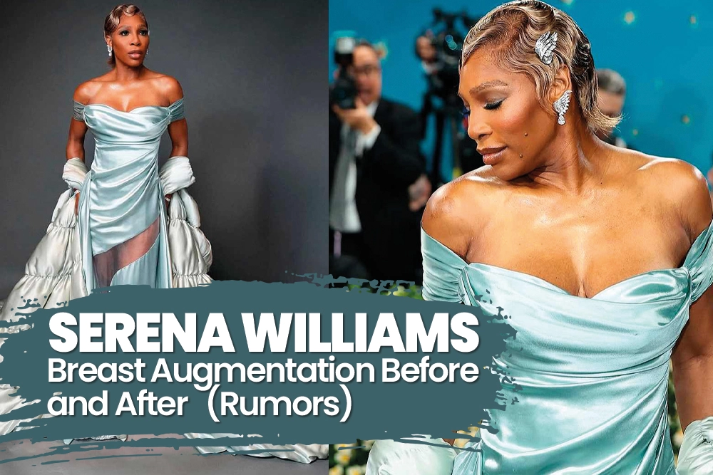 Serena Williams Breast Augmentation Before and After: The 2026 GLP-1 Analysis