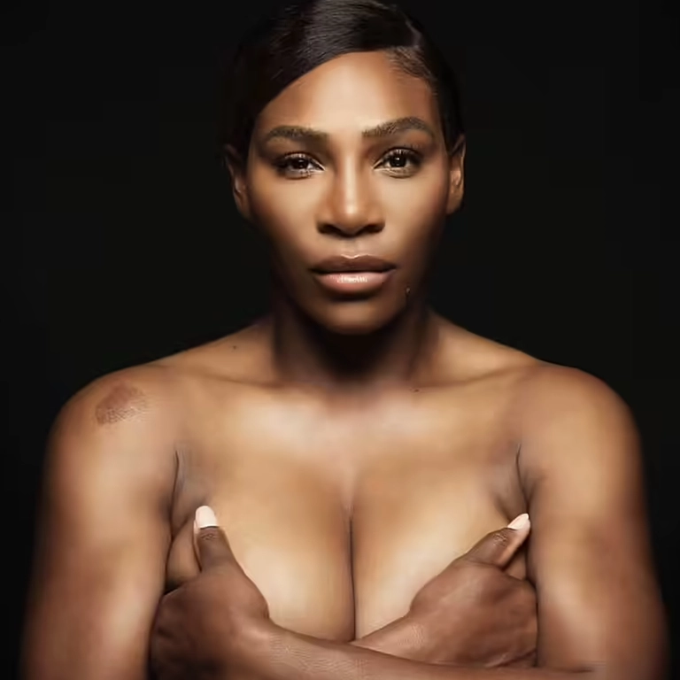 Serena Williams Plastic Surgery 2026 Confirmed vs Speculated