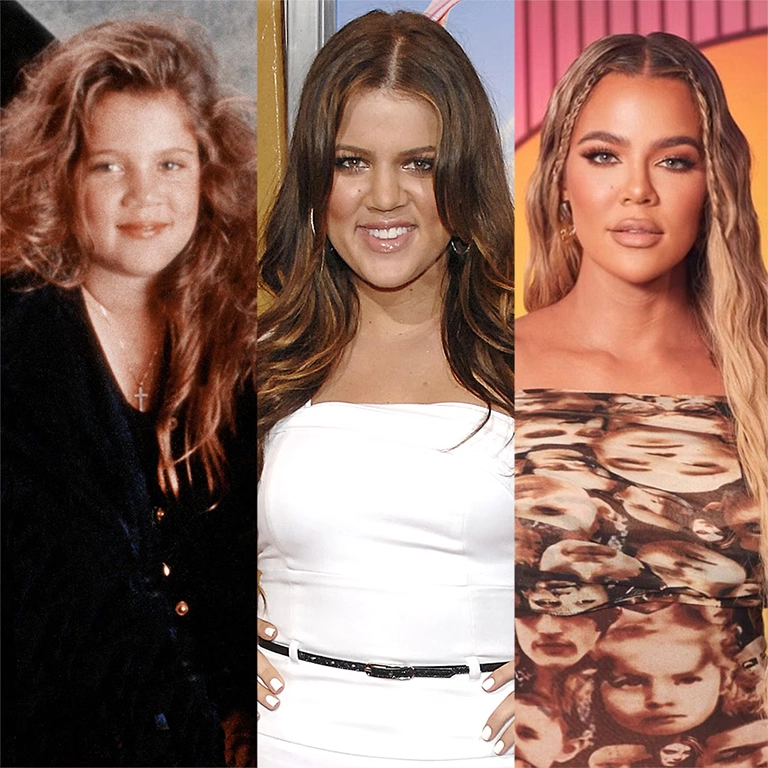 The Third Face Transplant Khloé Kardashian’s Nose Job Explained