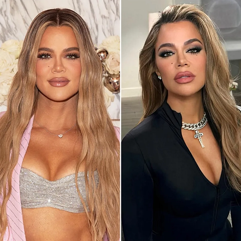 Why Khloé Kardashian Switched from Fillers to Skin Tightening Lasers
