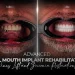 Advanced Full Mouth Implant Rehabilitation Sinus Lift and Zirconia Restorations
