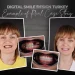 Advanced Full-Mouth Rehabilitation for Cleft Palate Klasia's Clinical Success Story