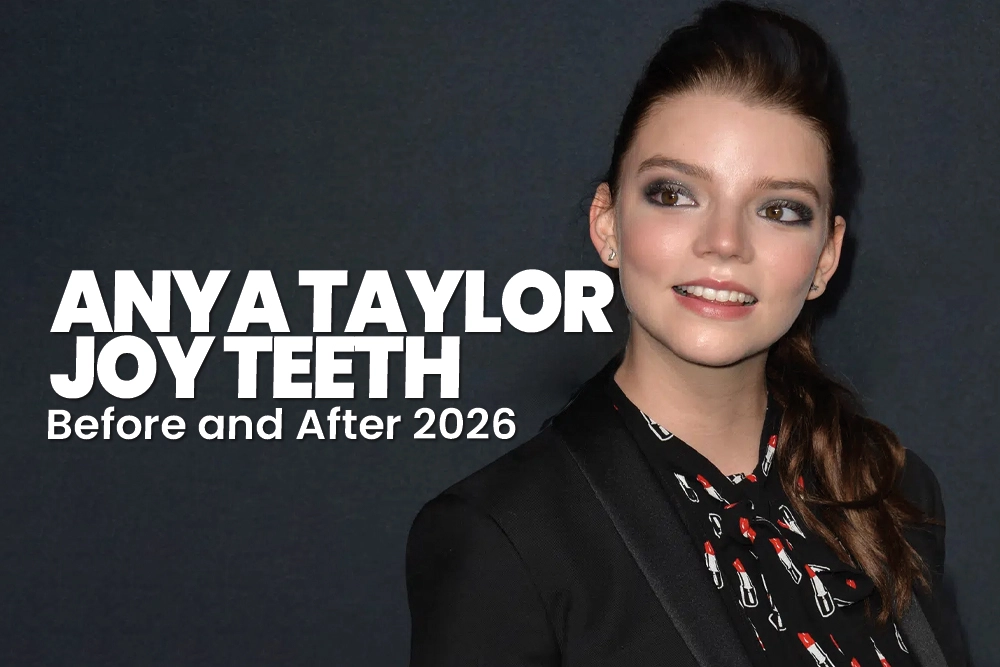 Anya Taylor-Joy Teeth