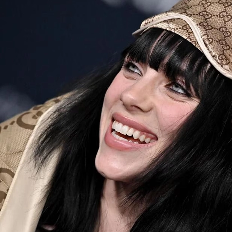 Billie Eilish Dental Bonding and Composite Rumors 2026