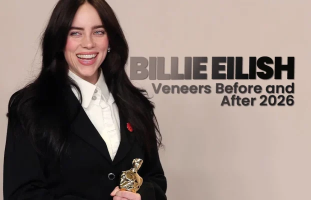 Billie Eilish Veneers Before and After