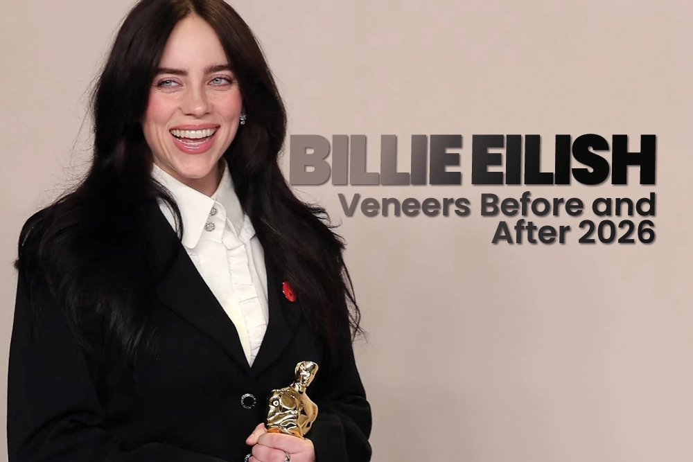 Billie Eilish Veneers Before and After