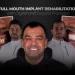 Complete Digital Full Mouth Implant Rehabilitation in Istanbul