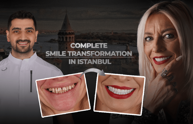 Complete Smile Transformation in Istanbul