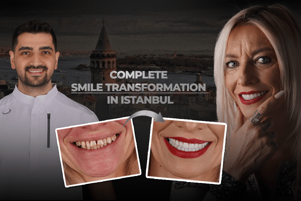 Complete Smile Transformation in Istanbul