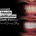Crossbite Correction & Dental Implants A Zirconium Case