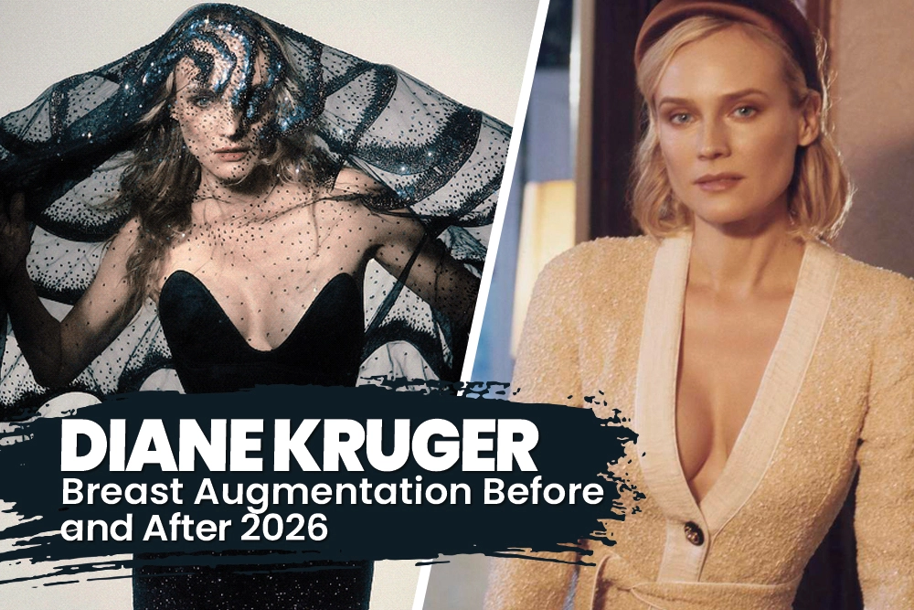 Diane Kruger Breast Augmentation Before and After 2026