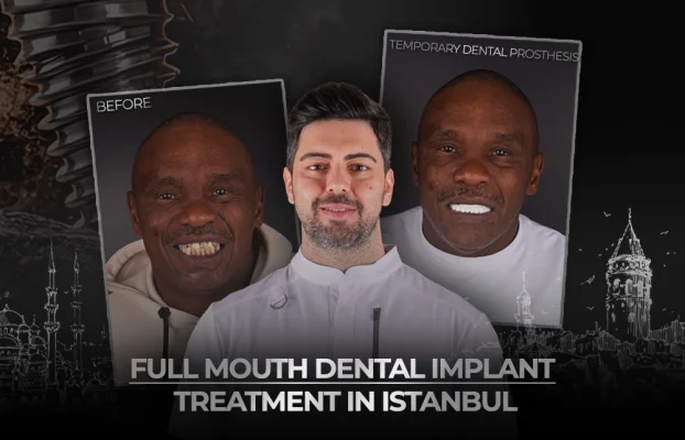 Full Mouth Dental Implant Treatment in Istanbul