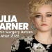 Julia Garner Plastic Surgery Before and After Architectural Face Analysis