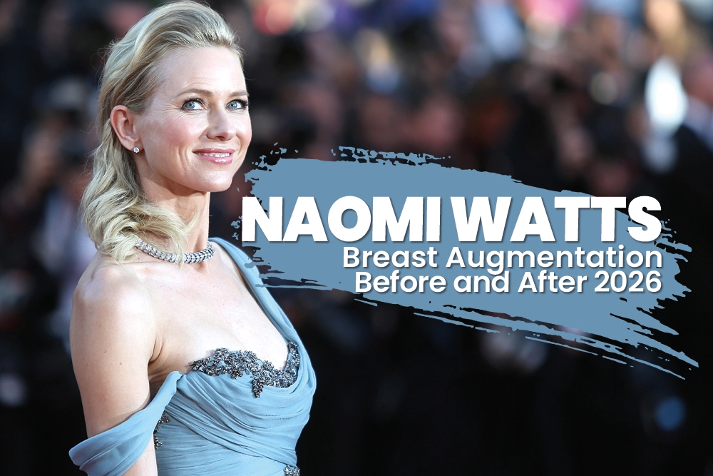 Naomi Watts Breast Augmentation Before and After 2026