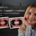 Nataliia's Smile Transformation Full-Mouth Implant Rehabilitation in Istanbul