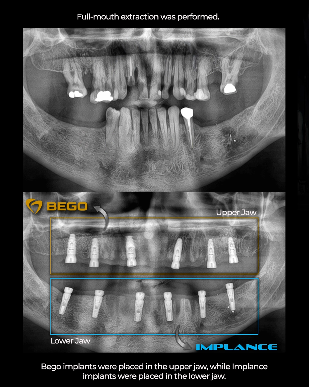 Revolutionary Face Scanning Technology for Smile Design