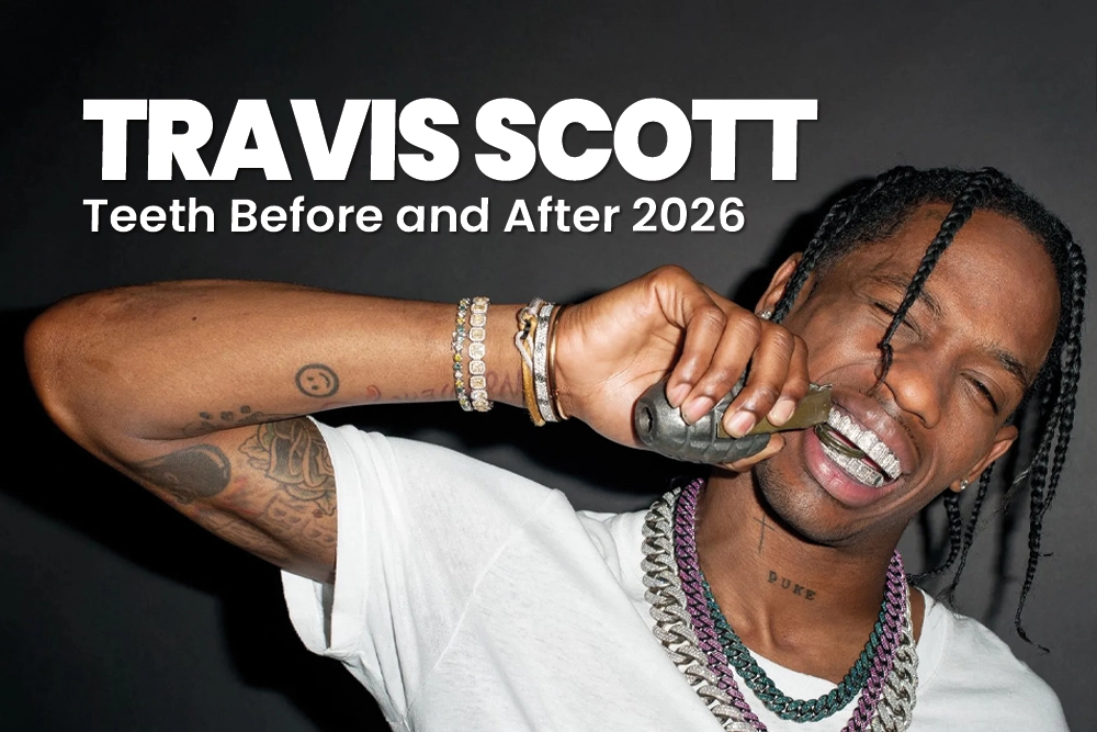Travis Scott Teeth Before and After 