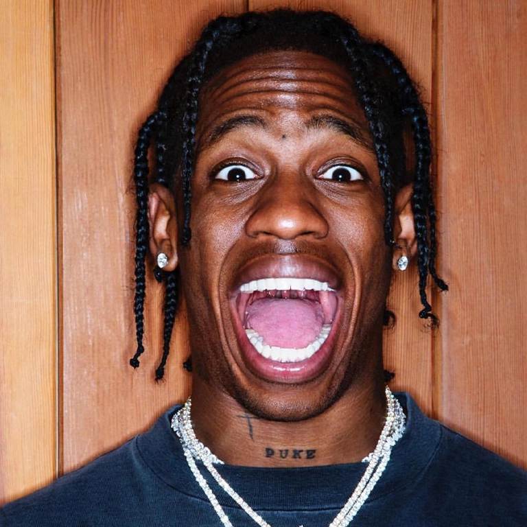 Travis Scott Teeth Straightening and Whitening Results
