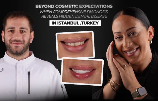 Beyond Cosmetic Expectations: When Comprehensive Diagnosis Reveals Hidden Dental Disease in Turkey, Istanbul