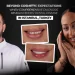 Beyond Cosmetic Expectations When Comprehensive Diagnosis Reveals Hidden Dental Disease in Turkey, Istanbul