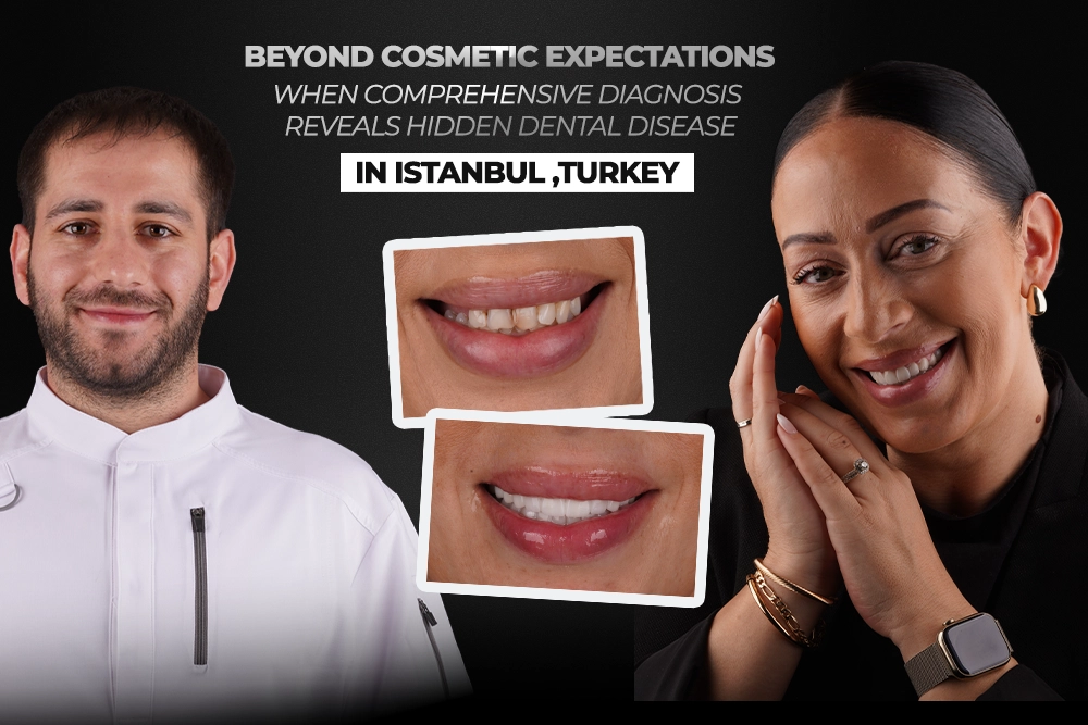 Beyond Cosmetic Expectations: When Comprehensive Diagnosis Reveals Hidden Dental Disease in Turkey, Istanbul