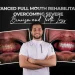Bohdan Advanced Full Mouth Rehabilitation Overcoming Severe Bruxism and Tooth Loss
