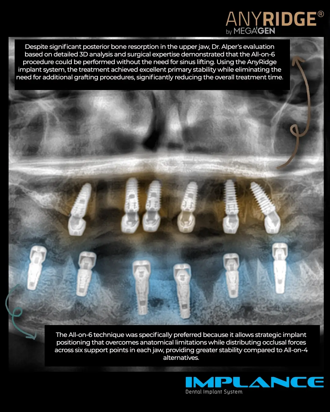 Complex Surgical Intervention by Dr. Alper Çağlayan Sarraf