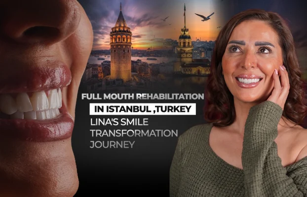 Full Mouth Rehabilitation in Turkey, Istanbul: Lina’s Smile Transformation Journey