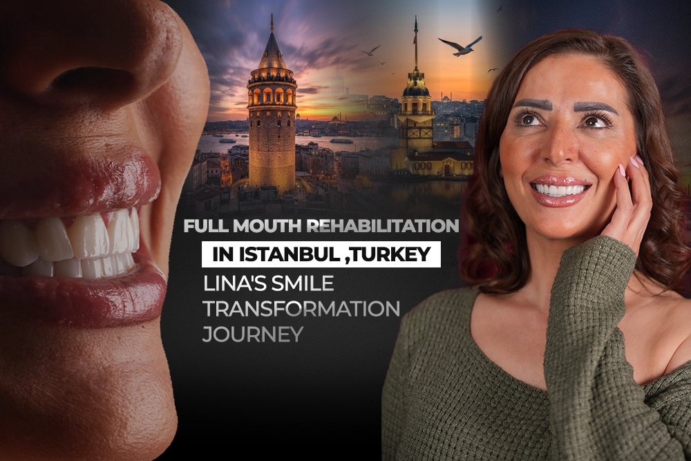 Full Mouth Rehabilitation in Turkey, Istanbul: Lina’s Smile Transformation Journey