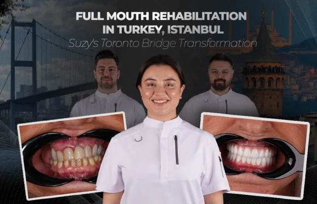Full Mouth Rehabilitation in Turkey, Istanbul: Suzy’s Toronto Bridge Transformation