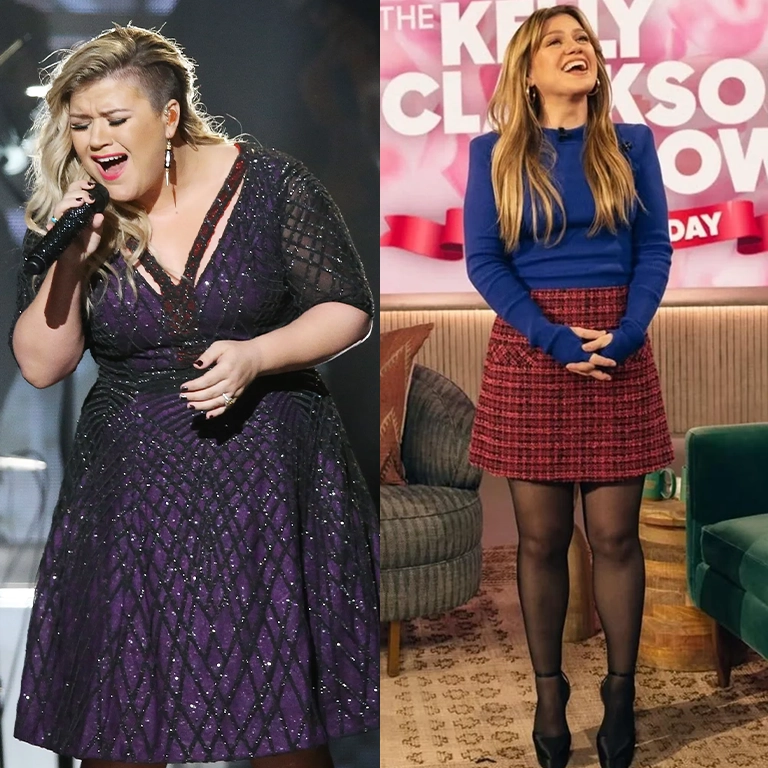 Kelly Clarkson Plastic Surgery Rumors Fact vs. Fiction